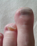 Toes